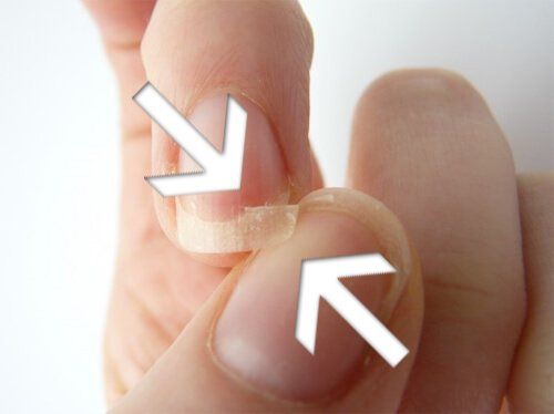 Weak Nails: Causes And Tips